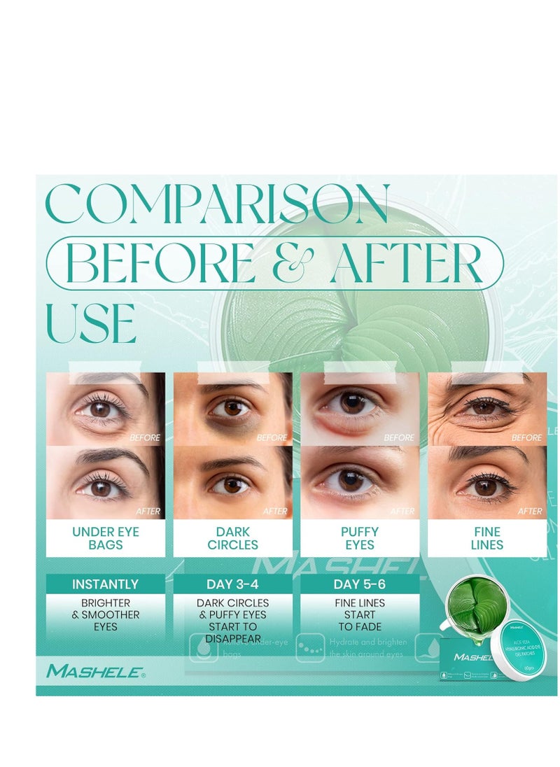 Korean 60pcs Aloe Vera Collagen Under Eye Gel Patches Mask, Treatment for Puffy Eyes, Dark Circles, Anti Wrinkle Pads, Moisturizing for Women and Men (60pcs patches aloe vera)