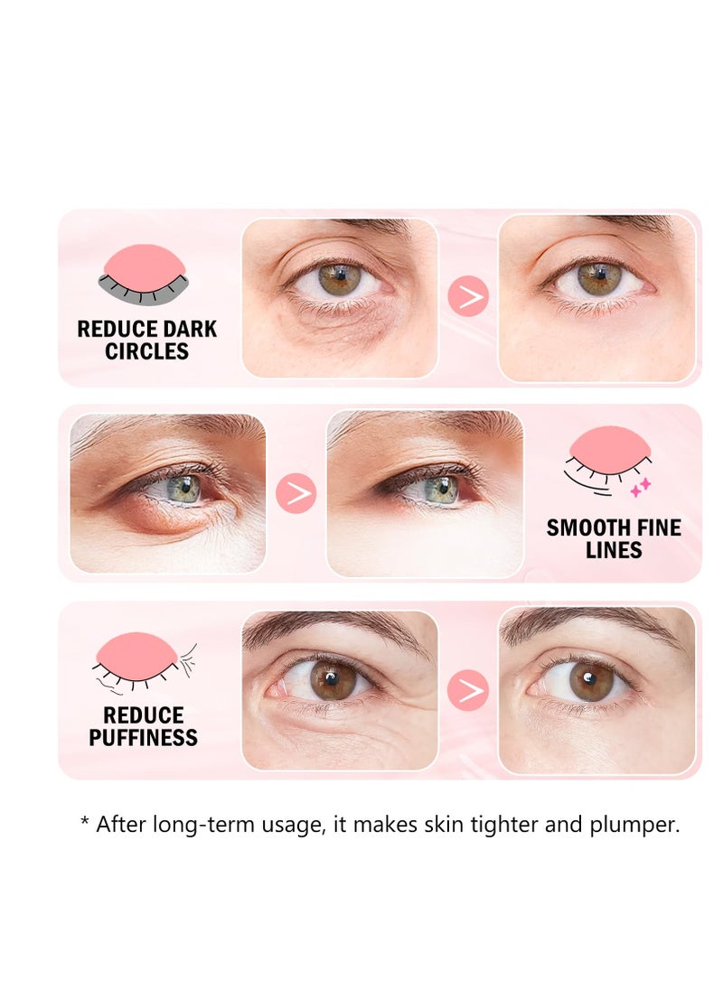 Under Eye Patches (30 Pairs) Hyaluronic Acid Eye Masks for Puffy Eyes, Dark Circles, Eye Bag, Wrinkles - Skin Care Gifts for Women, Under Eye Gel Patches