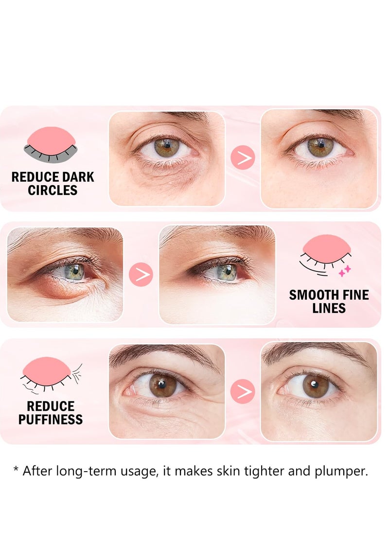 Under Eye Patches (30 Pairs) - 24K Gold Eye Mask for Puffy Eyes, Dark Circles, Under Eye Bags and Smooth Wrinkles, Eye Gel Pads With Collagen, Hyaluronic Acid & Castor Oil