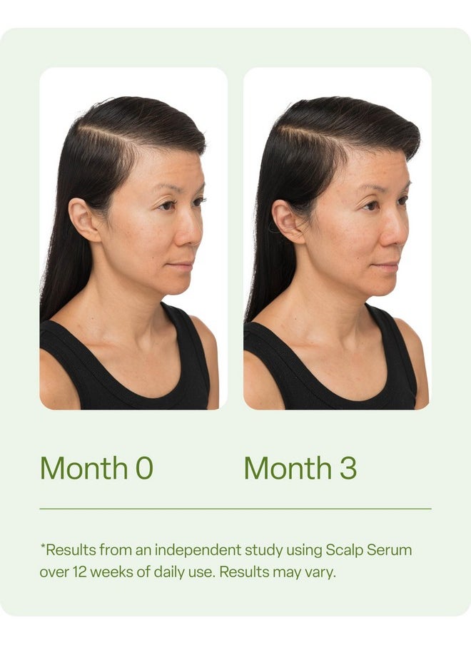 divi Scalp Serum for Thinning Hair, 30ml - Clinically Tested, Nourishing Formula with Amino Acids, Caffeine & Rosemary Oil - Promotes Healthy Scalp & Fuller-Looking Hair, Reduces Oil & Product Buildup