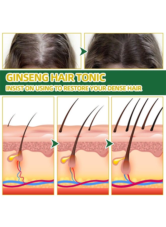 Natural Herbs , Ginseng Hair Thickening Liquid Ginseng Essence Hair Thickening Spray Prevents Hair Loss Strengthens Hair Protects and Moisturizes Hair 100ml