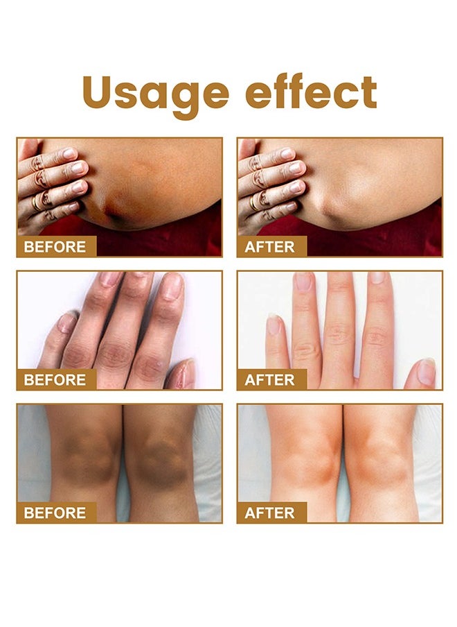 Therapy Drops,Dark Knuckle Whitening Serum 10 ML