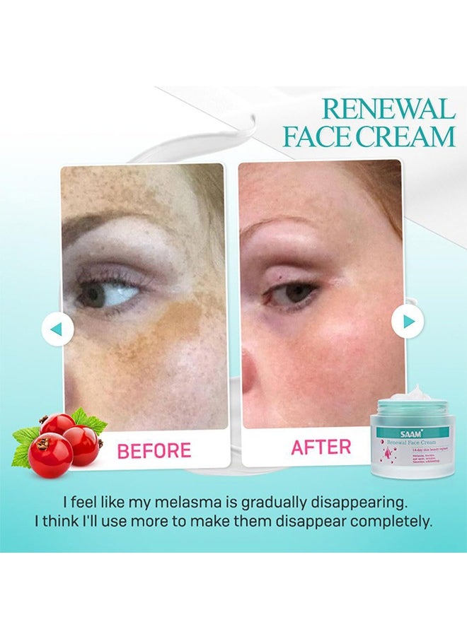 Saam Renewal Face Cream, Saam Cosmetics Cream Dark Spots Cream, Saam Renewal Face Cream 50g For Melasma And Freckles Treatment For All Skin Types, Anti-Wrinkle Face Cream, Saam Face Cream Korean