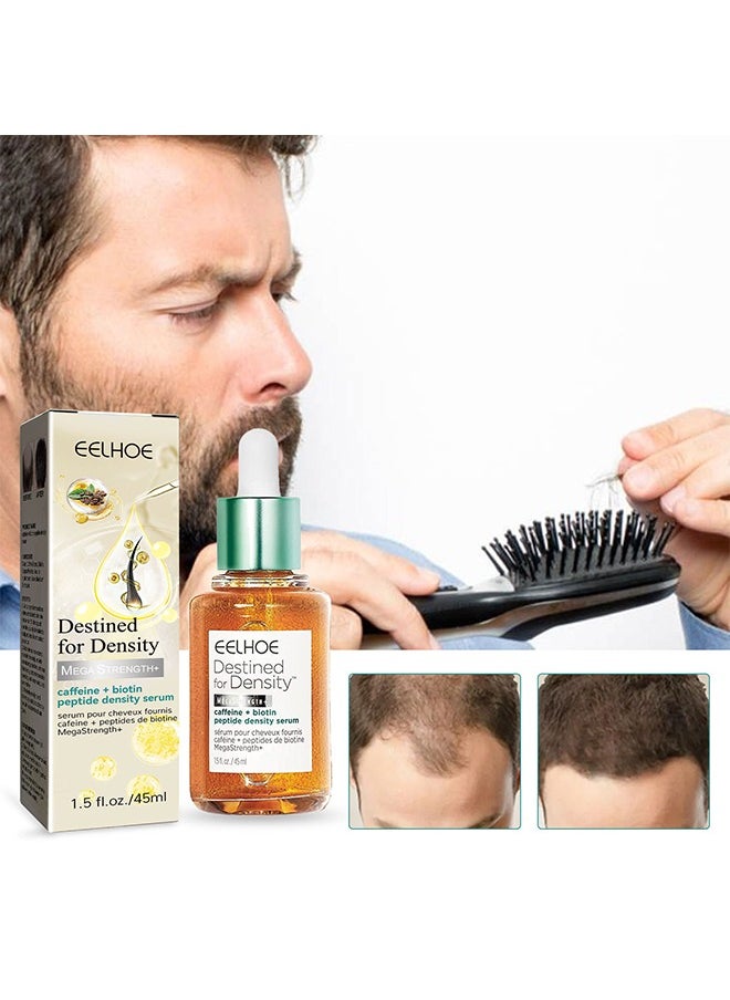 Hair Growth Serum - Biotin Hair Regrowth Oil Prevent Hair Loss and Helps Hair Thicker, Stronger, Longer Hair Treatment Men and Women (45 ML)