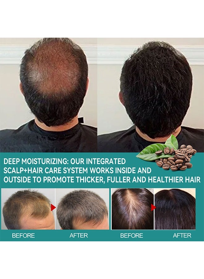 Hair Growth Serum - Biotin Hair Regrowth Oil Prevent Hair Loss and Helps Hair Thicker, Stronger, Longer Hair Treatment Men and Women (45 ML)