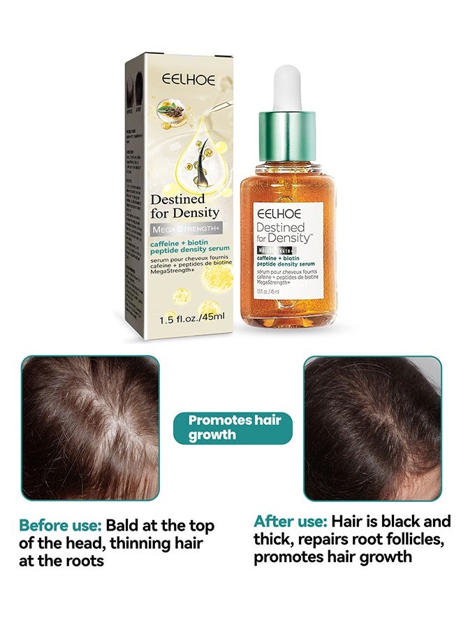 Hair Growth Serum - Biotin Hair Regrowth Oil Prevent Hair Loss and Helps Hair Thicker, Stronger, Longer Hair Treatment Men and Women (45 ML)
