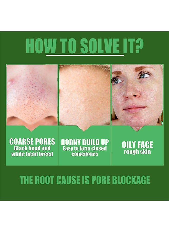 Green Tea Serum,Pore Shrinking Rejuvenates The Skin Moisturizing And Gently Shrinks,Anti-oxidation ,Oil control,hydrating and nourishing,Whitching Essenge (10ml）