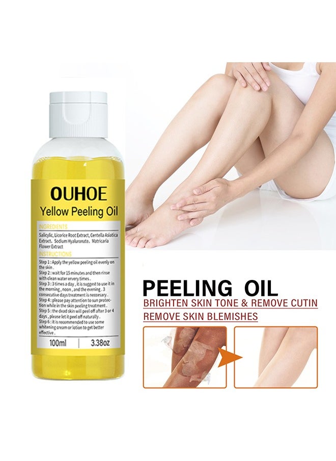 Yellow Peeling Oil Super Strength Exfoliating Dark Skin for Body,Skin Whitening Stretoh Marks Remover Peeling Solution with Salicylic Acid, Dark Spot Corrector for Body, Skin Brightening Peeling Solution for Dull Skin100ml
