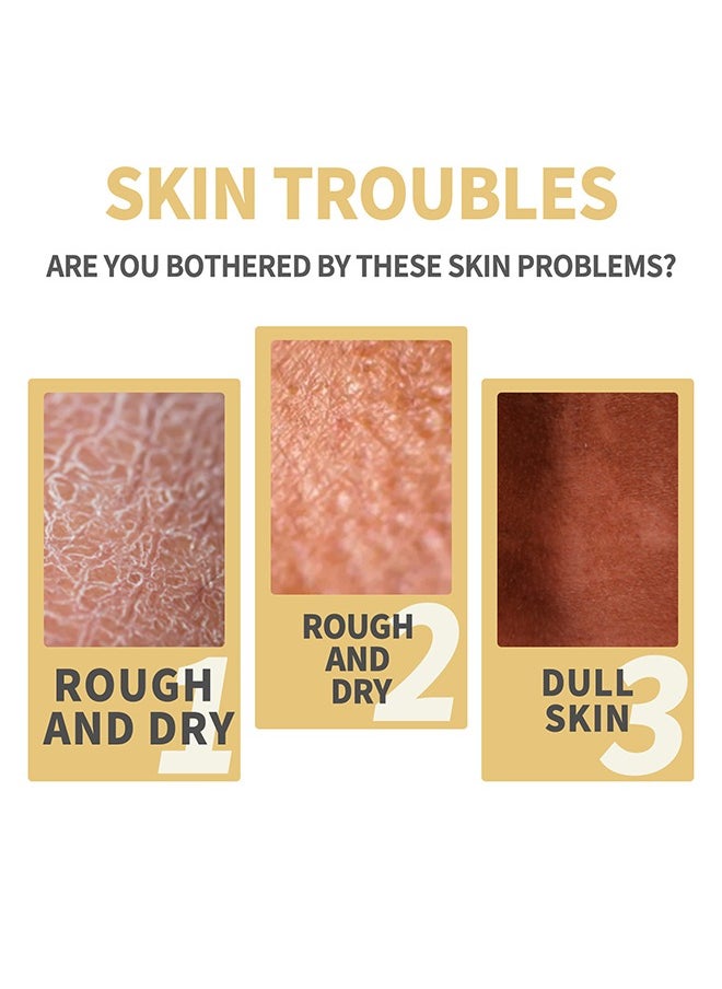 Yellow Peeling Oil Super Strength Exfoliating Dark Skin for Body,Skin Whitening Stretoh Marks Remover Peeling Solution with Salicylic Acid, Dark Spot Corrector for Body, Skin Brightening Peeling Solution for Dull Skin100ml