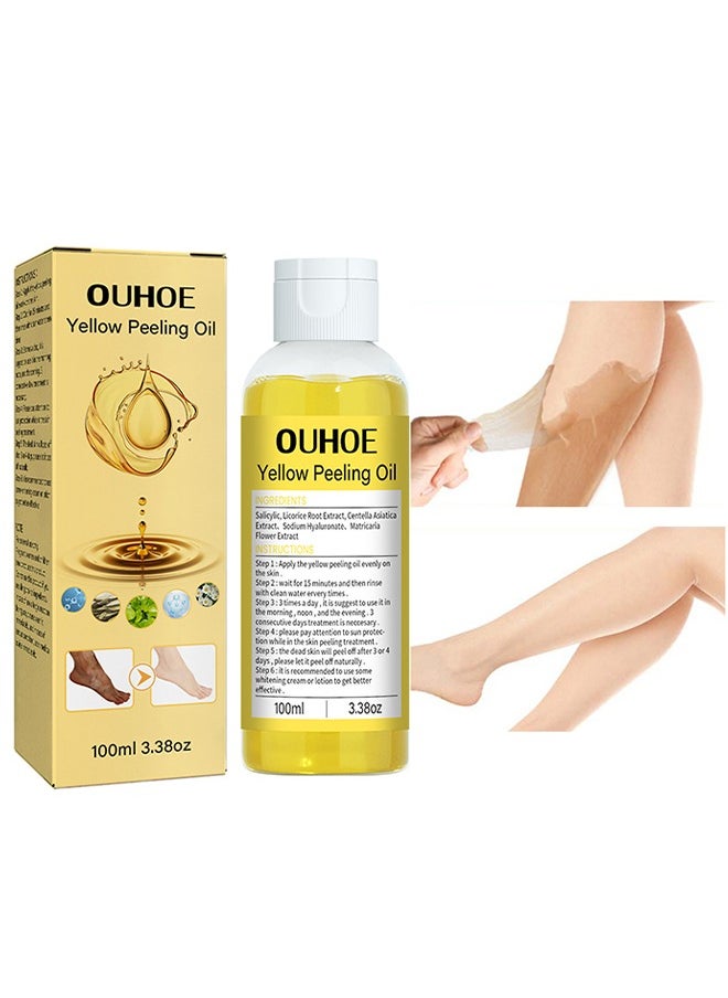 Yellow Peeling Oil Super Strength Exfoliating Dark Skin for Body,Skin Whitening Stretoh Marks Remover Peeling Solution with Salicylic Acid, Dark Spot Corrector for Body, Skin Brightening Peeling Solution for Dull Skin100ml