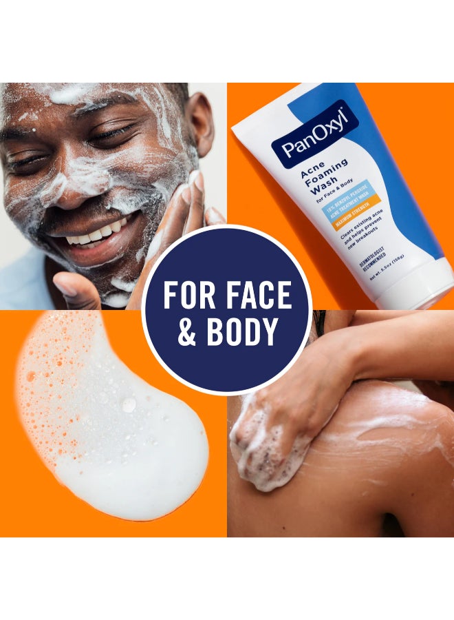 Pack Of 2 Acne Foaming Wash 156grams