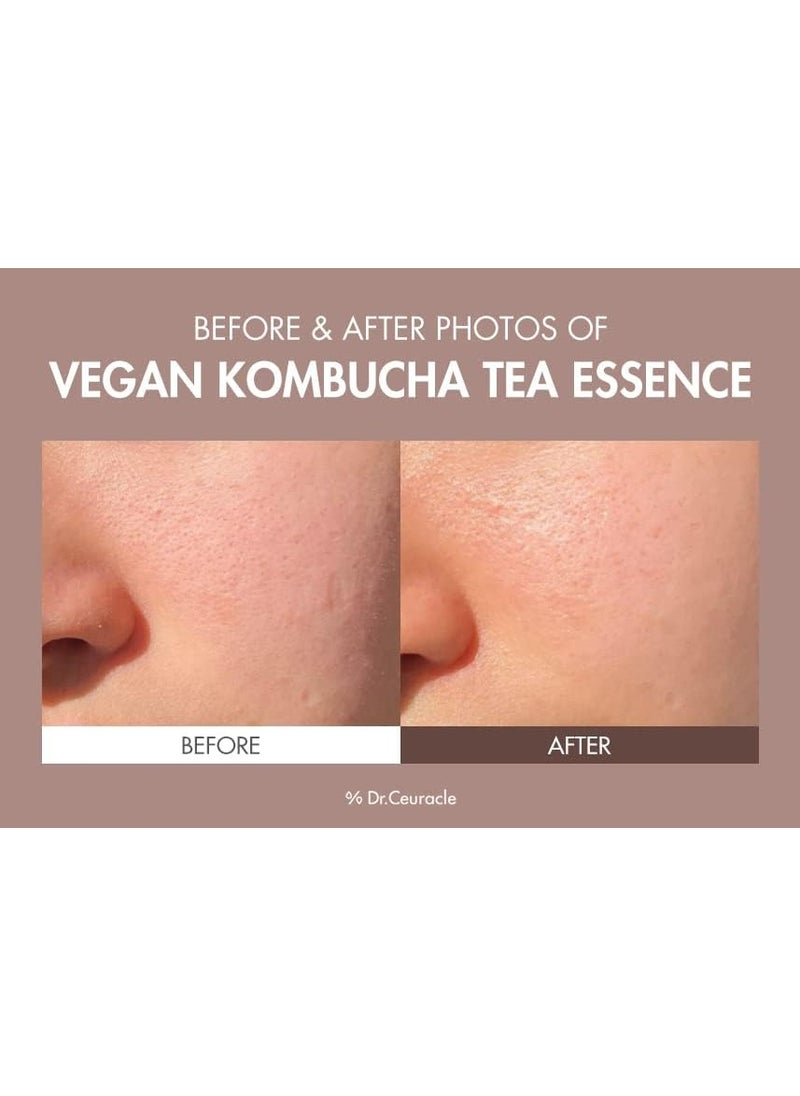 Vegan Kombucha Tea Essence - 150mL