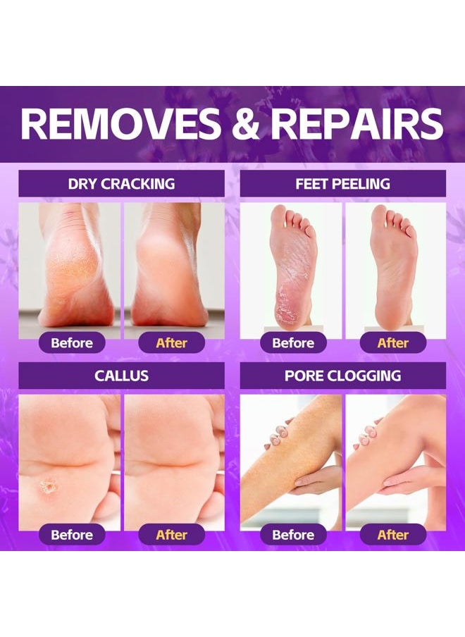 Pedicure Foot Soak, Foot Spa Soak, Pedicure Kit, Bubble Foot Bath For Tired & Dry Cracked Feet, Athletes Feet, Odor Foot and Softens Calluses, Foot Soak 16 Packs A Box, Lavender