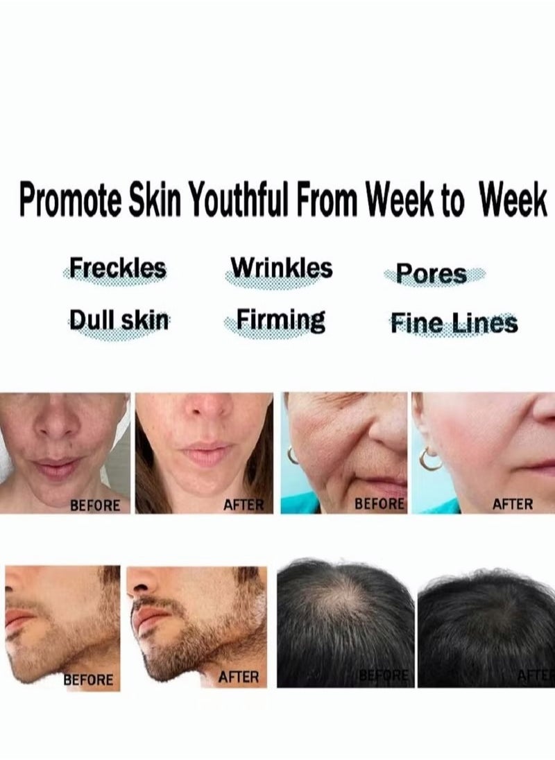 Dr. Pen Ultima M8 Professional Microneedling Pen - Cordless Derma Auto Pen - Best Face and Body Skincare Kit with 20pcs 36 pins