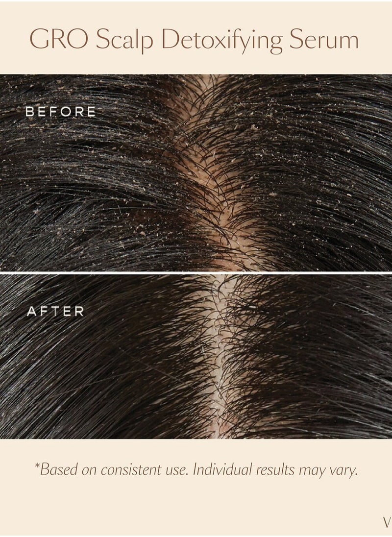 VEGAMOUR GRO Scalp Detoxifying & Clarifying Treatment for Dry, Flaky, Oily Scalp, 60ml – Deep Cleansing, Balancing, and Hydrating Formula with Plant-Based Ingredients