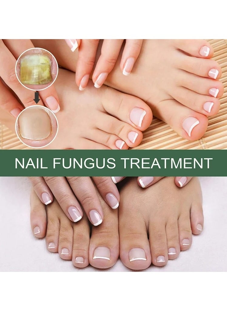 Fungus Solution for Hands &  Feet, 0.5 fl.oz