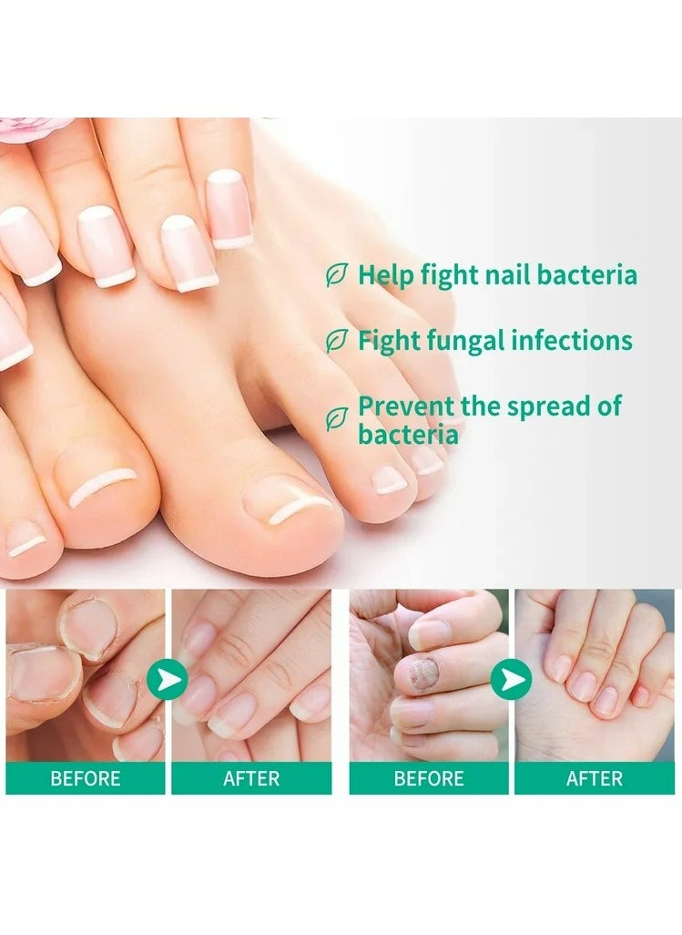 Fungus Solution for Hands &  Feet, 0.5 fl.oz