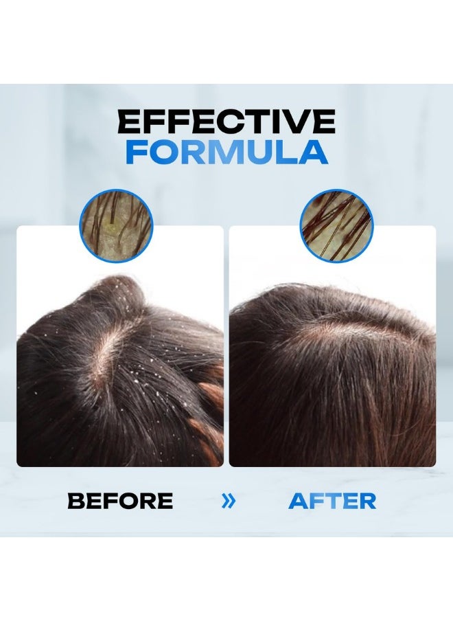 Cleansing Peeling Mask “CARBON EXTRA”. Effectively Cleanses The Scalp From Sebum And Impurities Without Drying Out The Scalp, 300 ml.