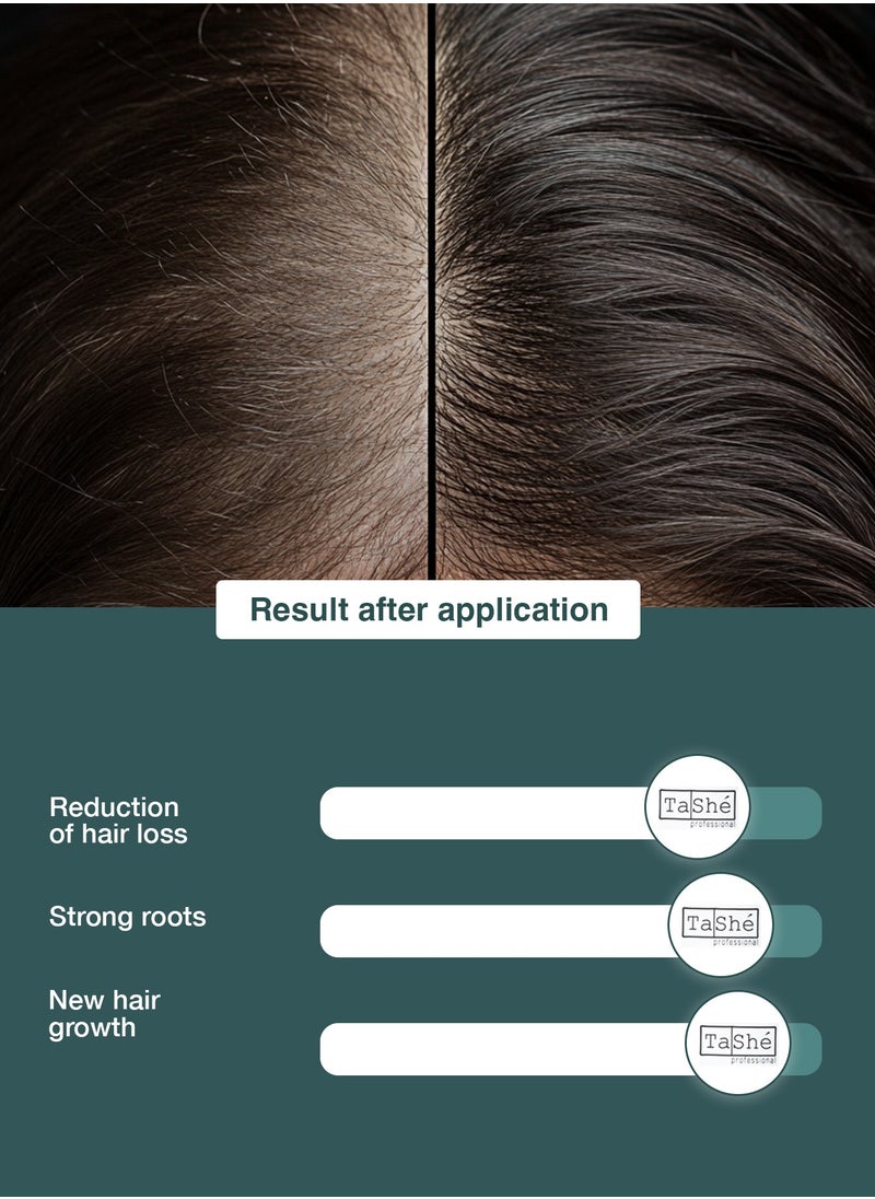 Rosemary & Biotin Hair Growth Oil | 100% Pure, Non-Greasy Formula | 4× Faster Regrowth & Hair Fall Control | Strengthens Roots, Soothes Itchy Scalp | 100 ml