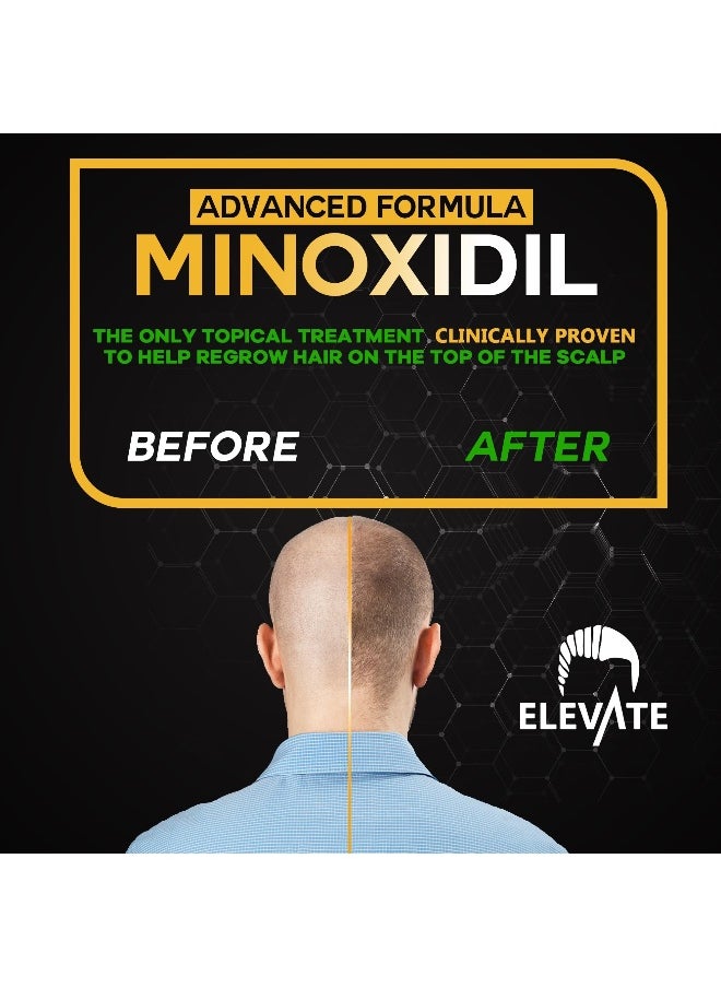 5% Minoxidil Hair Growth Spray for Men & Women - 1 to 2 Month Supply, 100ml