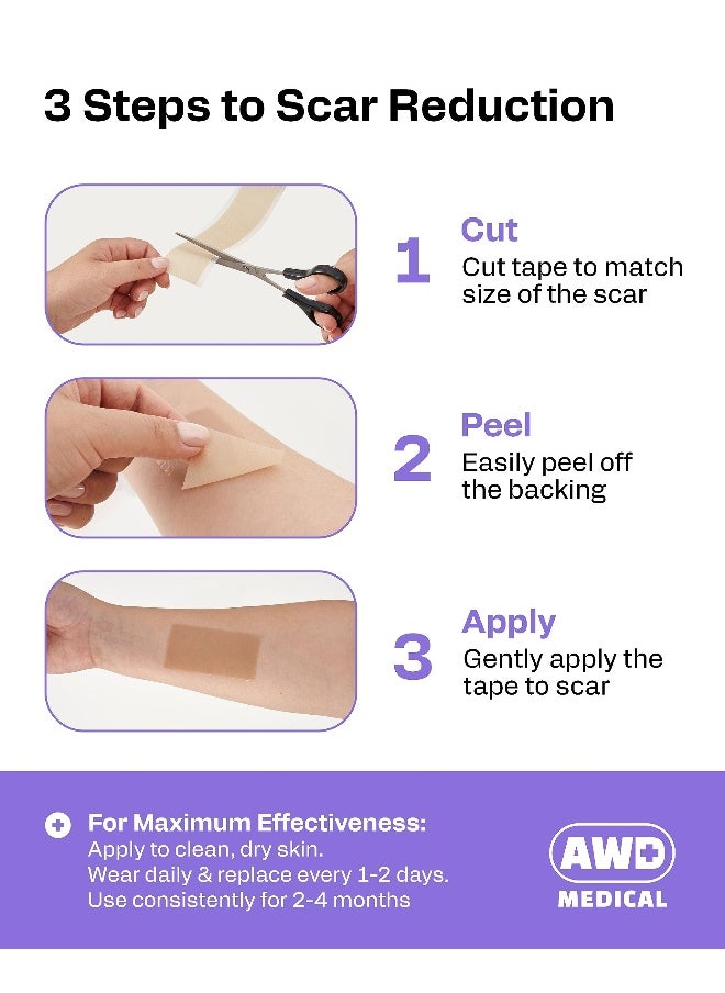 AWD Silicone Scar Sheets for Surgical Scars Medical Grade Silicone Scar Tape for C Section Tummy Tuck Tape Keloid Treatment Silicone Skin Patches After Surgery Must Haves 16 x 120 Roll
