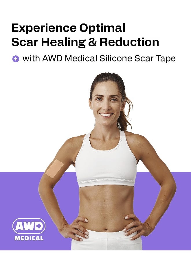 AWD Silicone Scar Sheets for Surgical Scars Medical Grade Silicone Scar Tape for C Section Tummy Tuck Tape Keloid Treatment Silicone Skin Patches After Surgery Must Haves 16 x 120 Roll