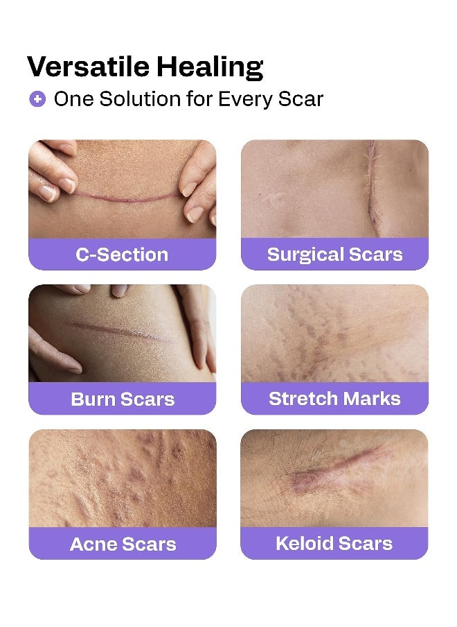 AWD Silicone Scar Sheets for Surgical Scars Medical Grade Silicone Scar Tape for C Section Tummy Tuck Tape Keloid Treatment Silicone Skin Patches After Surgery Must Haves 16 x 120 Roll