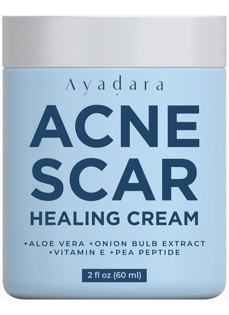 Acne Scar Healing Cream, 2 fl oz, Acne Scar Treatment for Face, Stretch Marks, Body Scars, Acne Scar Removal Cream for Body, Acne Scar Remover for Cuts and Burns, For All Skin Types, 200+ Uses