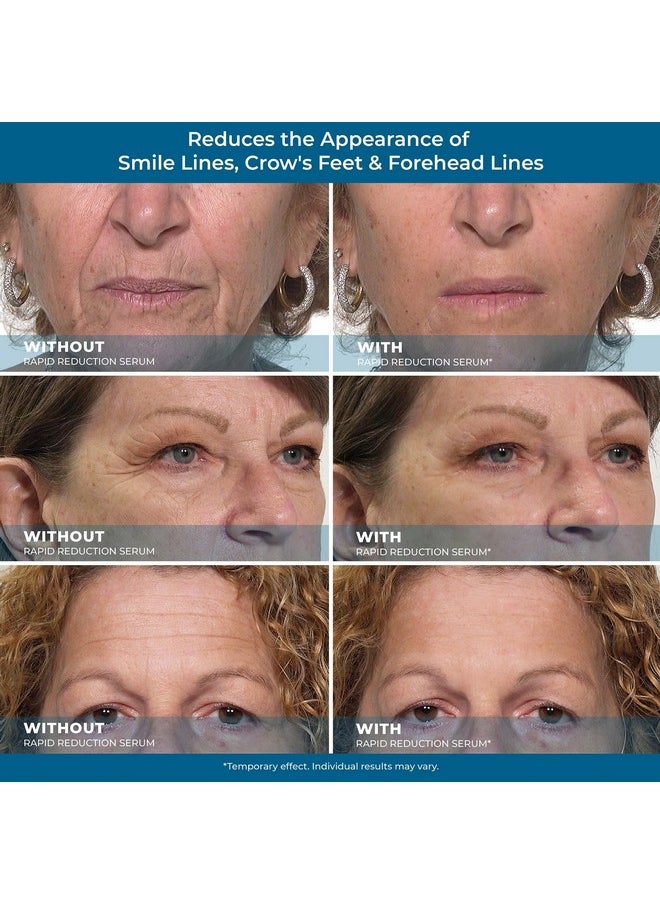 Plexaderm Rapid Reduction Eye Serum Pods - Advanced Formula - Anti Aging Serum Visibly Reduces Under Eye Bags, Wrinkles, Dark Circles, Fine Lines & Crow's Feet Instantly