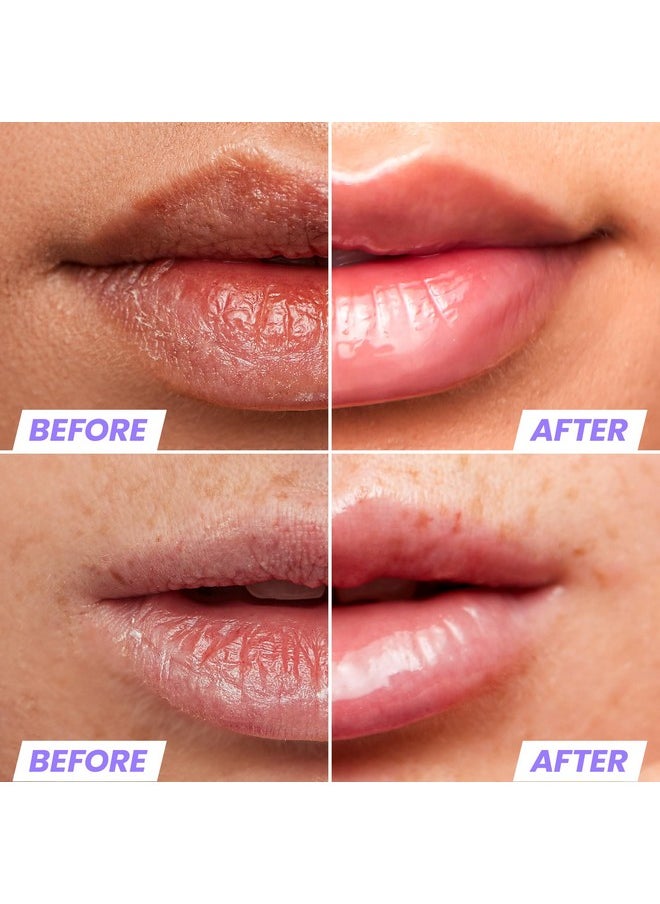Wonderskin Lip Oil - Lip Rehab Serum Oil, Hydrating and Moisturizing Clear Lip Oil for Dry Lips - Natural, Vegan and Non-sticky Lip Gloss Oil