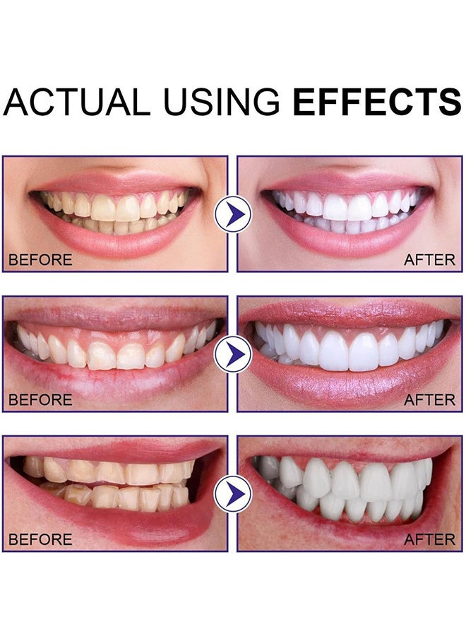 Teeth Whitening Essence, Flawless Teeth Remove Stains Safe Fresh Breath Gentle Non-Irritating Effective Clean Oral Care Products, Deep Cleaning Stains And Tartar Oral Care, Reduce Yellowing, 4ML