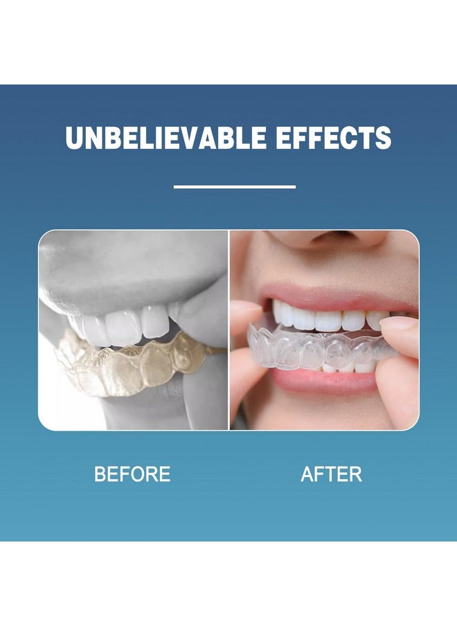 EZGO Retainer Cleaner Tablets, Denture Cleaning Tablets for Mouth Guard, Night Guard and Removable Dental Appliances, Removes Stains, Bad Odor, Plaque in 3 Minutes, 4 Months Supply (120 pcs)