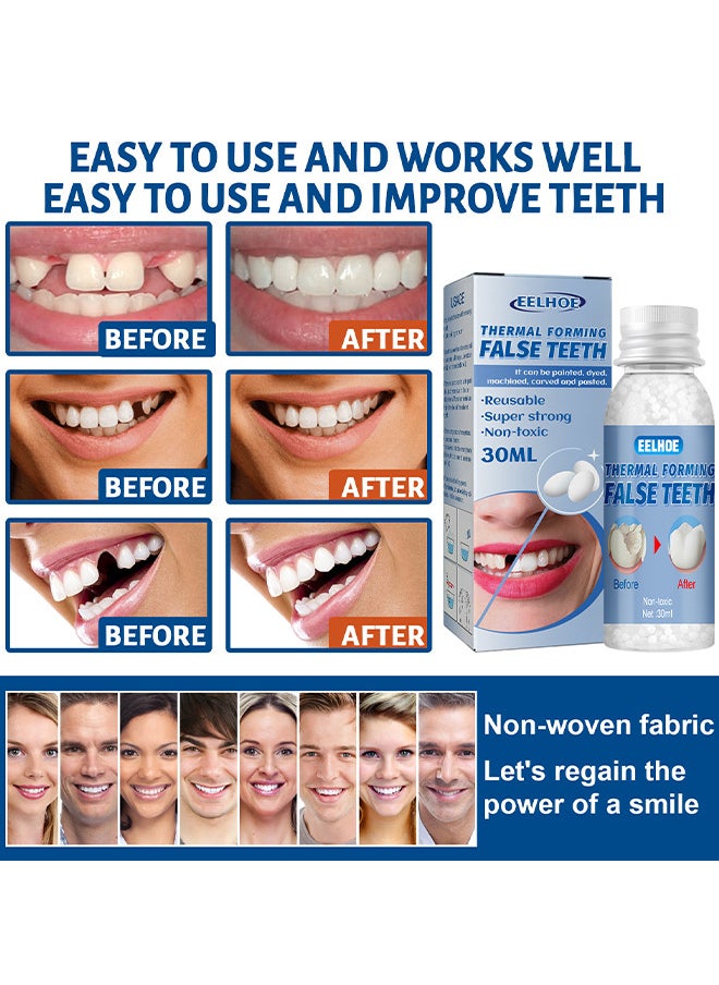 Temporary Tooth Repair Beads Tooth Repair Kit Teeth Filling Replacement For Chipped Teeth, Thermal Beads For Temporary Fix The Missing And Broken Tooth Fake Teeth 30ML