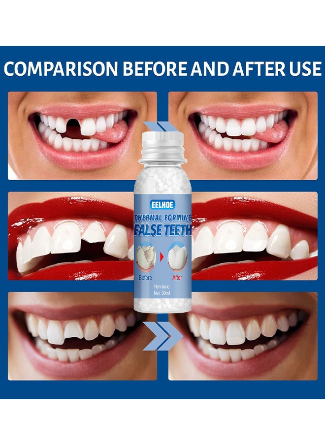 Temporary Tooth Repair Beads Tooth Repair Kit Teeth Filling Replacement For Chipped Teeth, Thermal Beads For Temporary Fix The Missing And Broken Tooth Fake Teeth 30ML