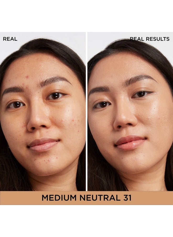 IT Cosmetics Bye Bye Dark Spots Concealer + Brightening Serum - 2% Niacinamide, Hyaluronic Acid & Caffeine - Medium Coverage, Natural Finish, All Skin Types - 31 Medium Neutral, 0.22 fl. oz