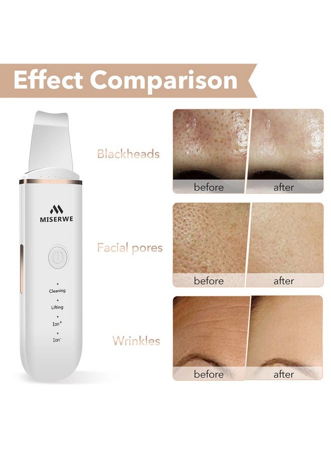 Skin Scrubber Face Skin Spatula Facial Scrubber Spatula for Deep Cleansing Blackhead Remover Pore Cleaner with 4 Modes (White)