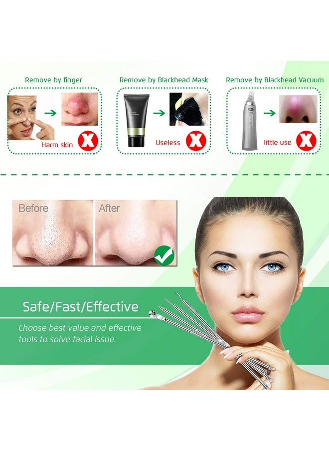 5PCS Blackhead Remover Comedone Extractor, Curved Blackhead Tweezers Kit, Professional Stainless Pimple Acne Blemish Removal Tools Kit