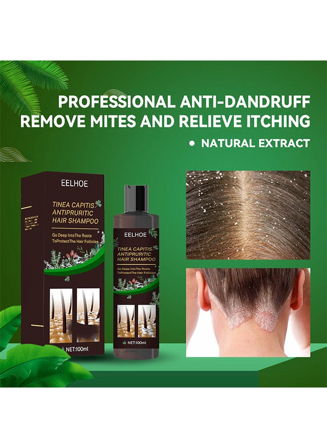 Tinea Capitis Antipruritic Hair Shampoo, Anti-Dandruff Shampoo, Shampoo For Scalp Prone To Folliculitis, Dermatitis, Dandruff, Mites, Itchy And Flaky Scalp, Treats Dandruff And Seborrheic Dermatitis