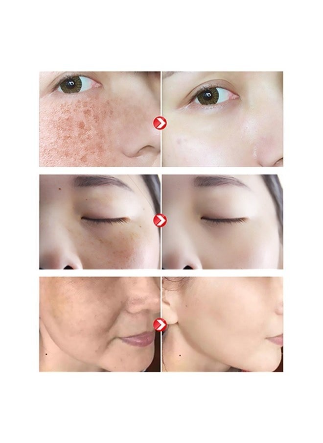 Brigentening And Freckle Removing Essence,Whitening And Freckle Removing Essence, Magic Whitening Spot Cream, Vitamin C Whitening Freckle Cream, Anti-Spot Serum for Face 40ml