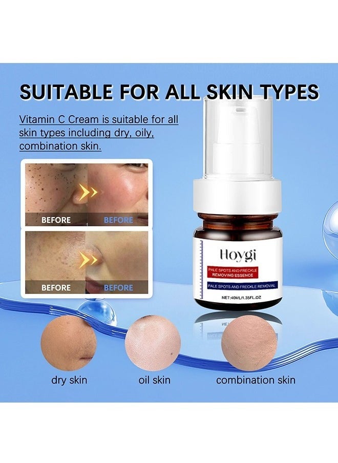 Brigentening And Freckle Removing Essence,Whitening And Freckle Removing Essence, Magic Whitening Spot Cream, Vitamin C Whitening Freckle Cream, Anti-Spot Serum for Face 40ml