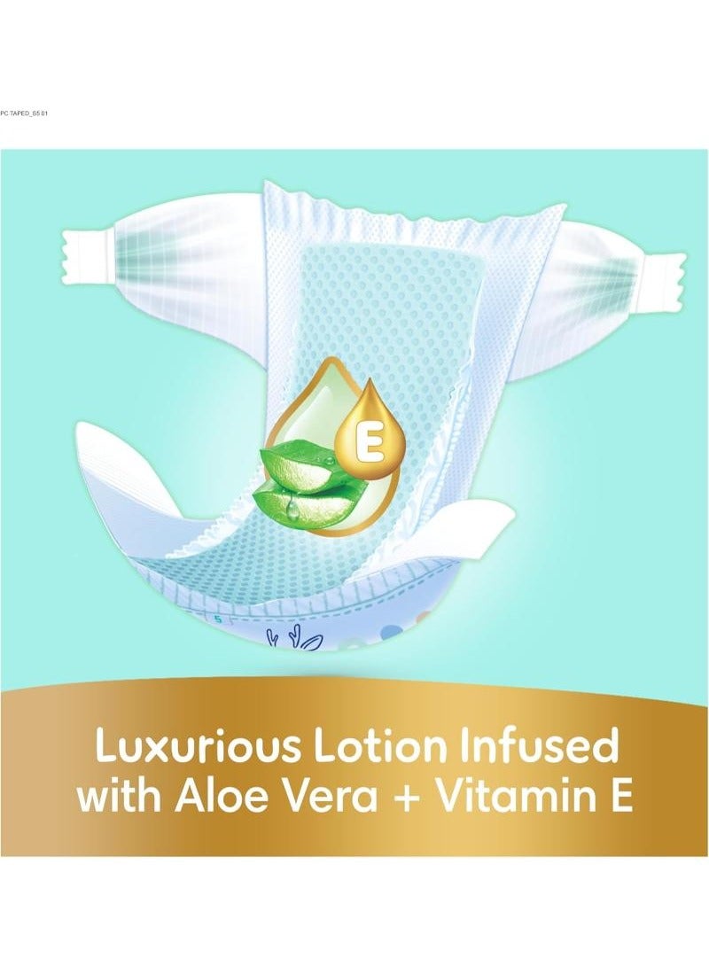 Ultimate Comfort Size 5 11-16kg Taped Diapers Lotion Infused With Aloe Vera And Vitamin E Giga Box