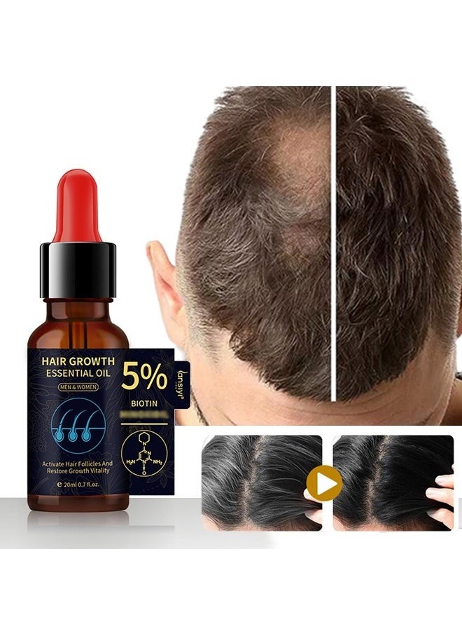 Hair Growth Essential Oil ，5% Minoxidil and Biotin with Natural Herbal Extract for Women Men Hair Regrowth Hair Loss Hair Thinning Treatment 20ml