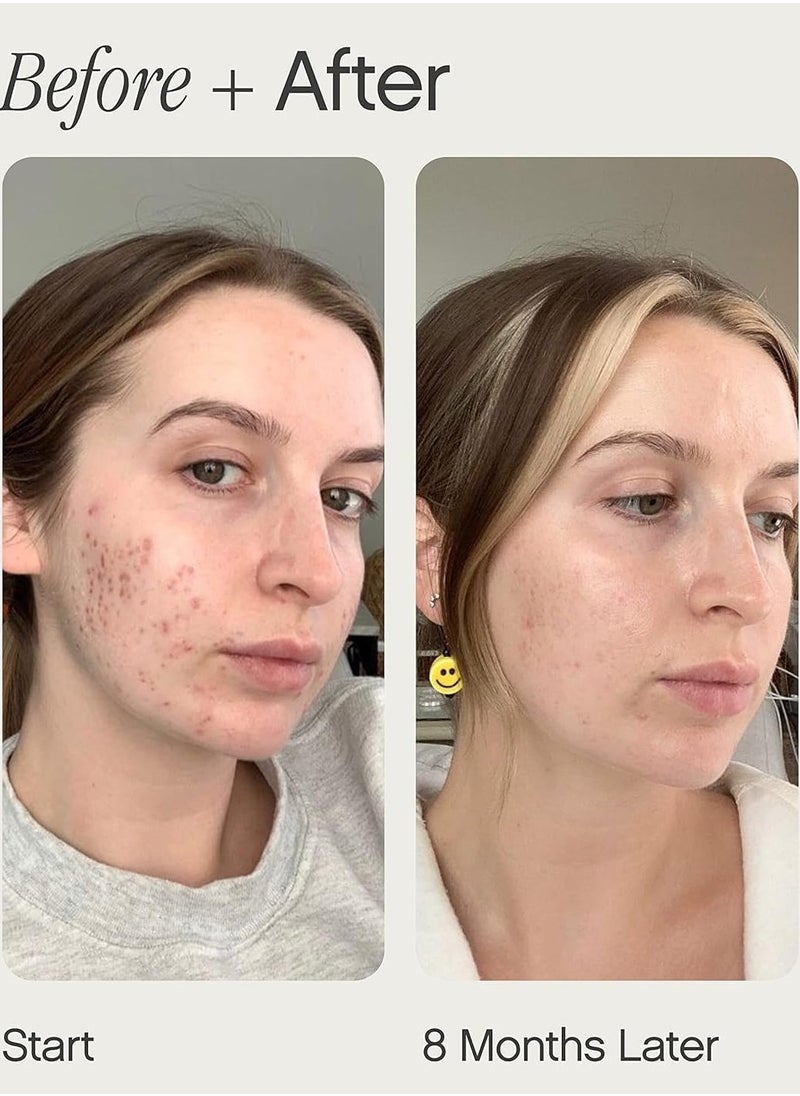 Faded Brightening & Clearing Serum, 15 mL
