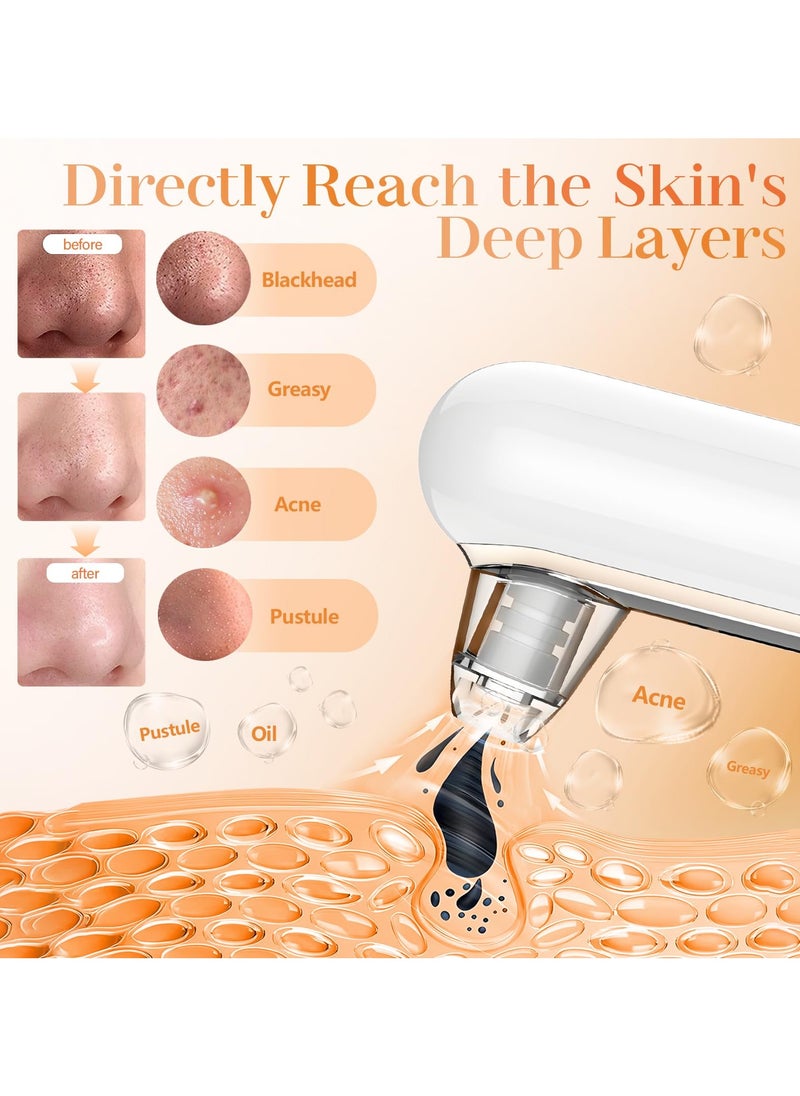 Blackhead remover, vacuum pore extractor, blackhead remover, suitable for facial blackhead extractor, pore vacuum acne extractor, skin label removal tool, pore cleaner, with USB charging, 4 modes, 5 suction heads