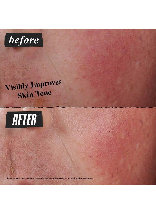Kiehl's Ultra Facial Advanced Repair Barrier Cream, Intensive Treatment Relieves Dry + Sensitive Skin, Rapidly Reduces Redness and Soothes, Fast-Absorbing Breathable Formula, Paraben-Free - 1.7 fl oz