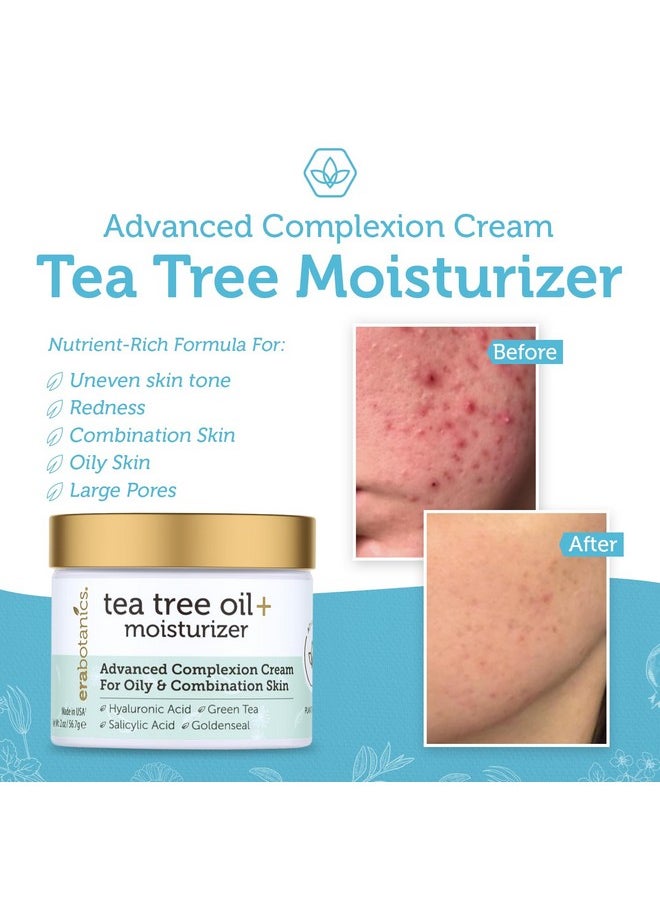 Era Organics Tea Tree Cream Face Moisturizer for Oily Skin - Advanced 7X Balancing Oily Skin Moisturizer - Non-Greasy Moisturizer - Tea Tree Oil for Skin