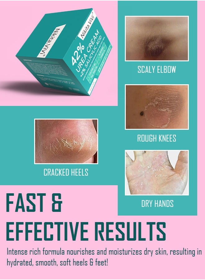 150g 42% Urea Cream Salicylic Acid Cream for Cracked Feet Hands Callus Remover Hand Cream Foot Cream for Cracked Foot Heels Elbows Nails Knees Skin Moisturizer Urea Lotion with Maximum Strength