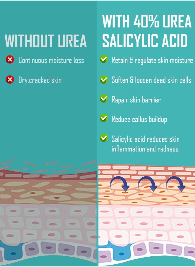 150g 42% Urea Cream Salicylic Acid Cream for Cracked Feet Hands Callus Remover Hand Cream Foot Cream for Cracked Foot Heels Elbows Nails Knees Skin Moisturizer Urea Lotion with Maximum Strength