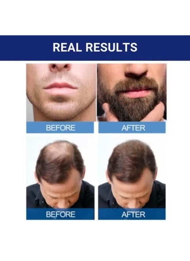 Minoxidil Extra Strength Hair Regrowth Treatment with Dropper - 5% 60mlx2