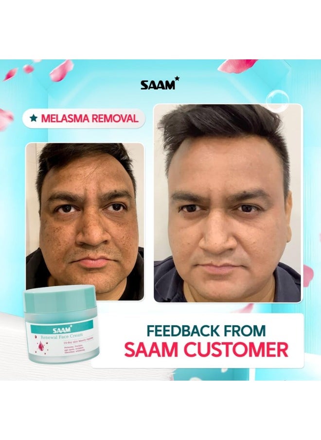 SAAM Renewal Face Cream | Melasma, Freckles, Age Spots & Dark Spots | With Alpha Arbutin and Kojic Acid | 50g